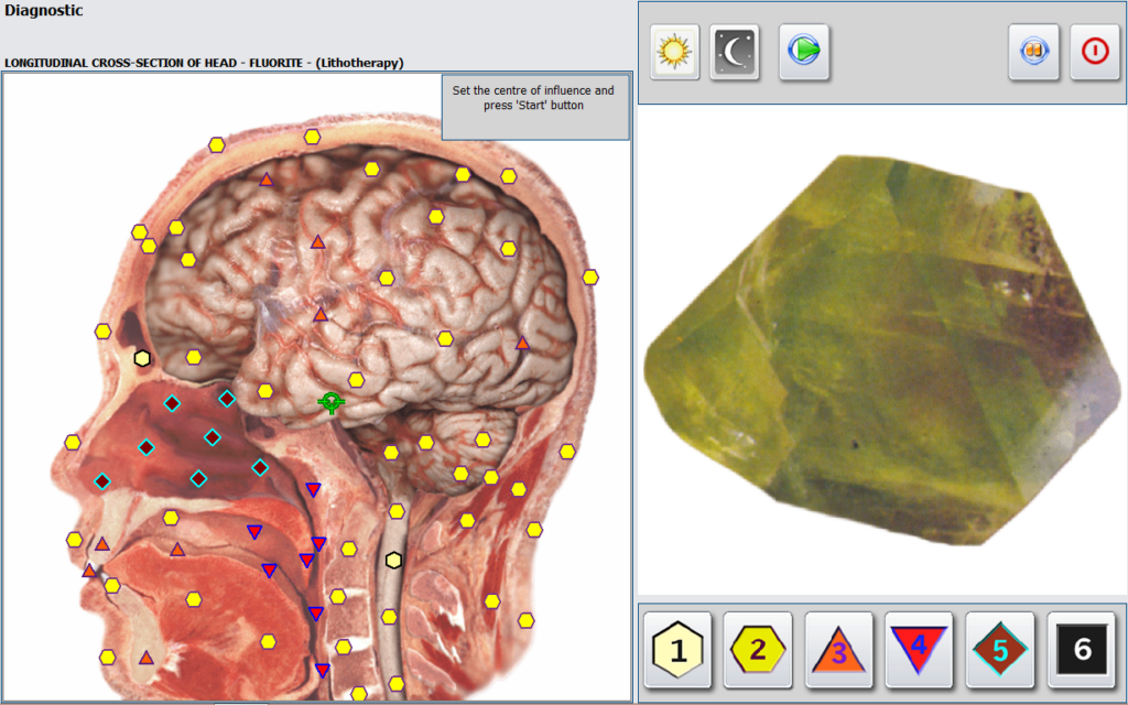 scan en behandeling met hunter metapathia